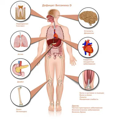 Витамин D, анализ на витамин Д (25-OH), показания к назначению, правила  подготовки к сдаче анализа, расшифровка результатов и показатели нормы. картинки