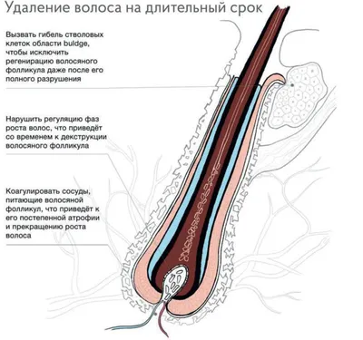 Фото и лазерная эпиляция в Алматы картинки