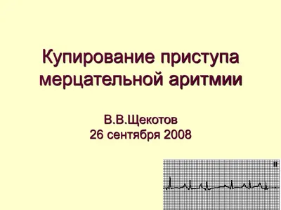 PPT - Купирование приступа мерцательной аритмии В.В.Щекотов 26 сентября  2008 PowerPoint Presentation - ID:3826339 картинки