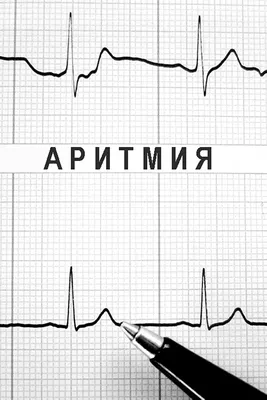 Aritmiya (1992) - IMDb картинки