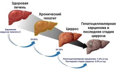 Отек ног: что делать и как лечить заболевание - Клиника в Уручье картинки