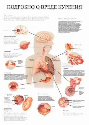 Купить Подробно о вреде курения - постер, цена 30 грн — Prom.ua  (ID#1598237645) картинки