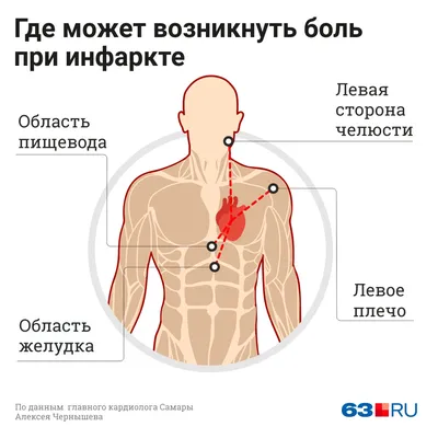 Как кофе влияет на работу сердца и как начинается инфаркт — комментарий от  главного кардиолога Самары Алексея Чернышева - 21 октября 2019 - 63.ru картинки