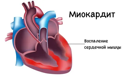 Как понять, что болит сердце? Рекомендации кардиолога картинки