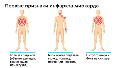 Боль в области сердца: симптомы, признаки, как понять, виды боли в сердце картинки