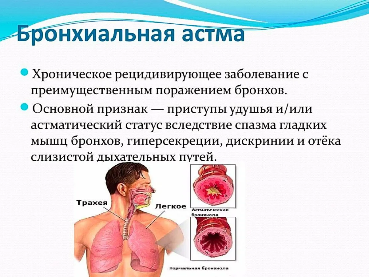Болезни органов дыхания бронхиальная астма