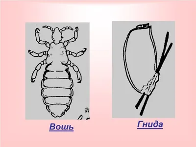 Рисунок вши (47 фото) » Рисунки для срисовки и не только картинки