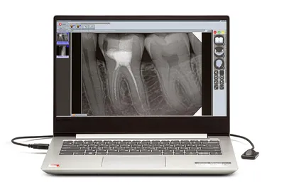 New Life Radiology Mercury DIGISENS - цифровой радиовизиограф с ноутбуком,  купить в GREEN DENT, акции и специальные цены. картинки